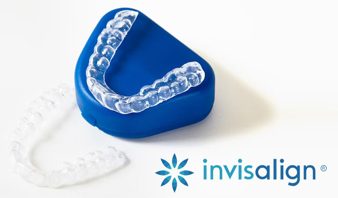 Invisible Aligners Treatment in Gurgaon