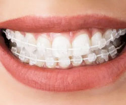 upper teeth